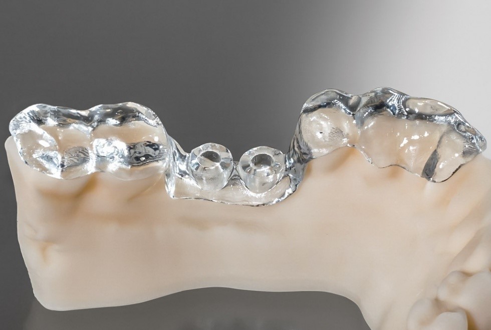 3D打印牙科手术导板.jpg