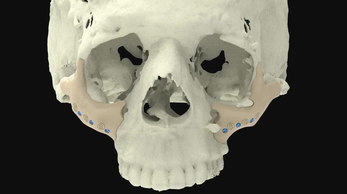 3D打印骨骼模型头骨.jpg