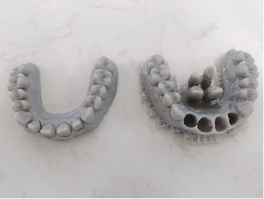 3D打印树脂牙齿模型.png