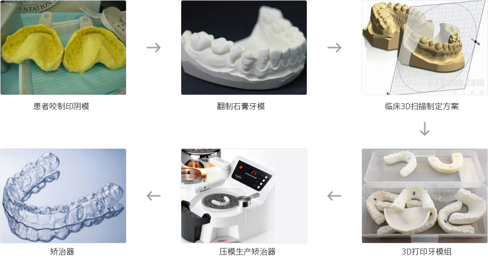 3D打印技术用于牙齿矫正.png